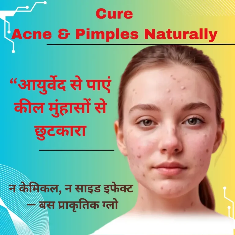 How Ayurveda Can Help with Acne & Pimples Naturally