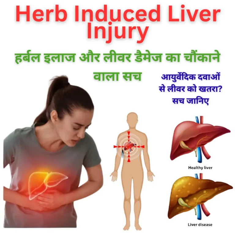 Herb Induced Liver Injury