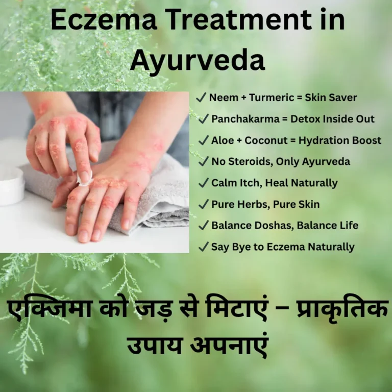 Eczema Treatment in Ayurveda
