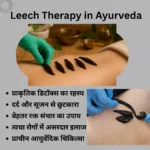 Leech Therapy in Ayurveda