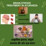 Brain Stroke Treatment in Ayurveda