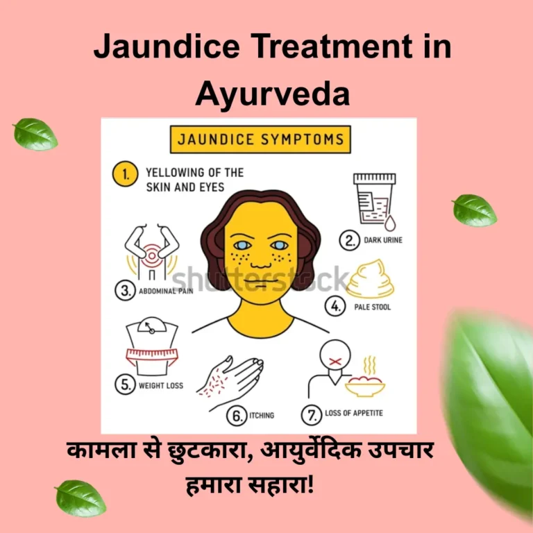 Jaundice Treatment in Ayurveda