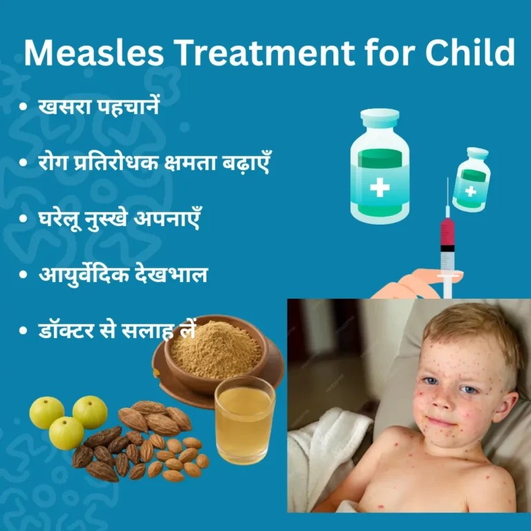 Measles Treatment for Child