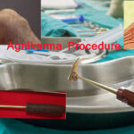 agnikarma