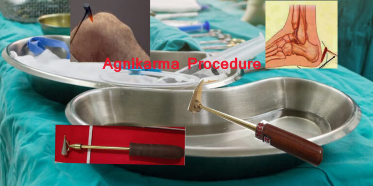 agnikarma